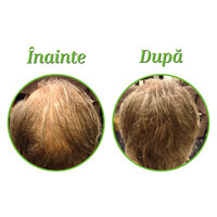 fibre-naturale-de-keratina-pentru-densificarea-parului-dark-blond-12-5-g-the-cosmetic-republic-7738.jpg