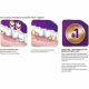 Crema adeziva pentru proteza dentara Corega Power Max Fixare + Sigilare, 70 g, Gsk 572995