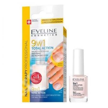 Tratament pentru unghiile piciorului 9 in 1 Total Action, 12 ml, Eveline Cosmetics
